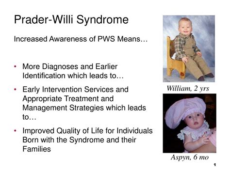 prada willy syndrome|prader willi syndrome fact sheet.